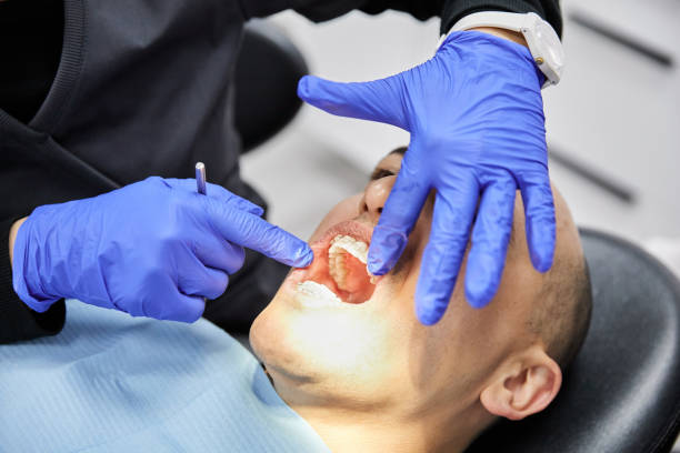 Best Knocked-Out Tooth (Avulsed Tooth) Treatment in Guttenberg, IA